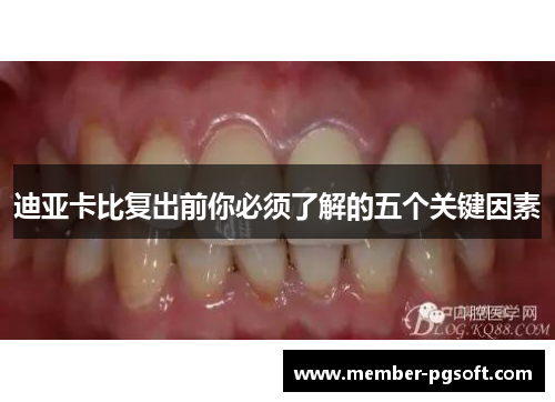 迪亚卡比复出前你必须了解的五个关键因素
